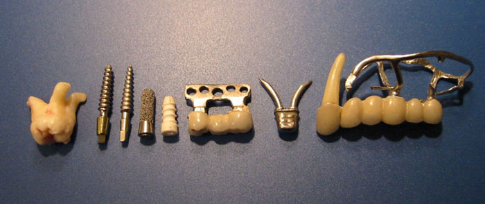 Различные виды  дентальных имплантатов поднадкостничный,	якорный,   пластинчатый,   керамический  винтовой,	цилиндрический титановый, конические титановые.